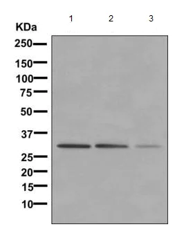 Western blot - Anti-NgBR antibody [EPR8668] (AB168351)
