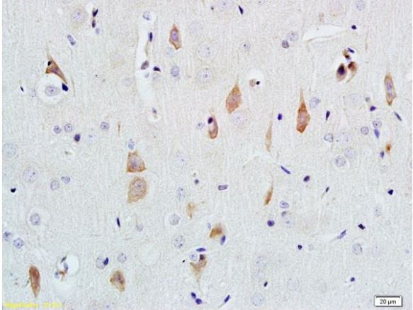 Immunohistochemistry (Formalin/PFA-fixed paraffin-embedded sections) - Anti-NGF antibody (AB216419)