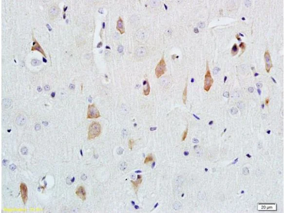 Immunohistochemistry (Formalin/PFA-fixed paraffin-embedded sections) - Anti-NGF antibody (AB216419)