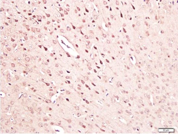 Immunohistochemistry (Formalin/PFA-fixed paraffin-embedded sections) - Anti-NGF antibody (AB216419)