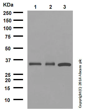 Western blot - Anti-NGF antibody [EP1320Y] (AB52918)