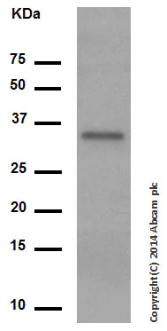 Western blot - Anti-NGF antibody [EP1320Y] (AB52918)