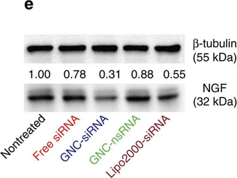 Western blot - Anti-NGF antibody [EP1320Y] (AB52918)