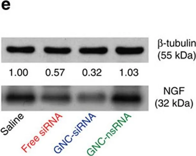 Western blot - Anti-NGF antibody [EP1320Y] (AB52918)