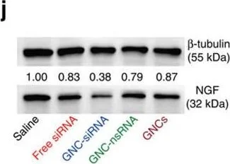 Western blot - Anti-NGF antibody [EP1320Y] (AB52918)