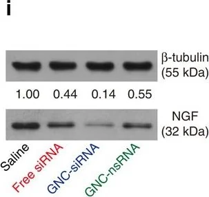 Western blot - Anti-NGF antibody [EP1320Y] (AB52918)