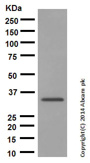 Western blot - Anti-NGF antibody [EP1320Y] (AB52918)
