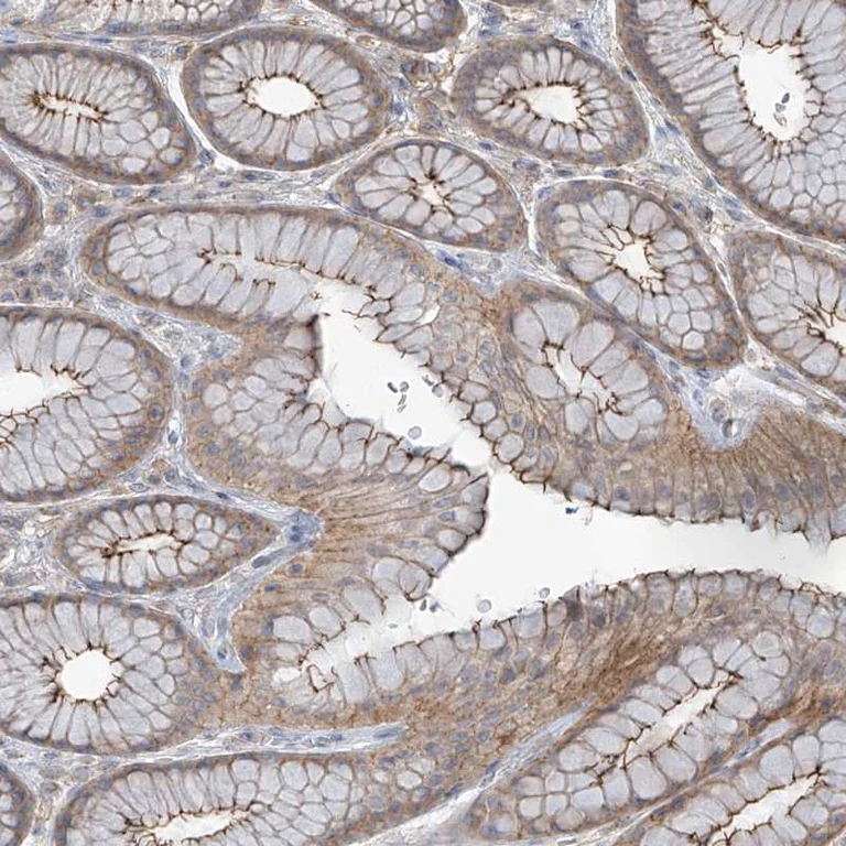 Immunohistochemistry (Formalin/PFA-fixed paraffin-embedded sections) - Anti-NHE-2 antibody (AB254787)