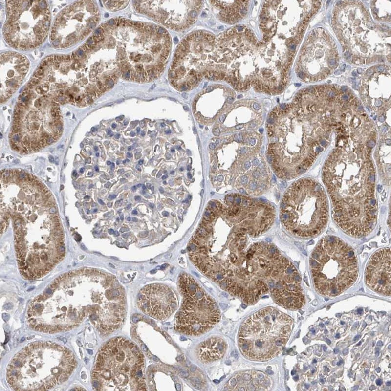 Immunohistochemistry (Formalin/PFA-fixed paraffin-embedded sections) - Anti-NHE-7 antibody (AB272649)