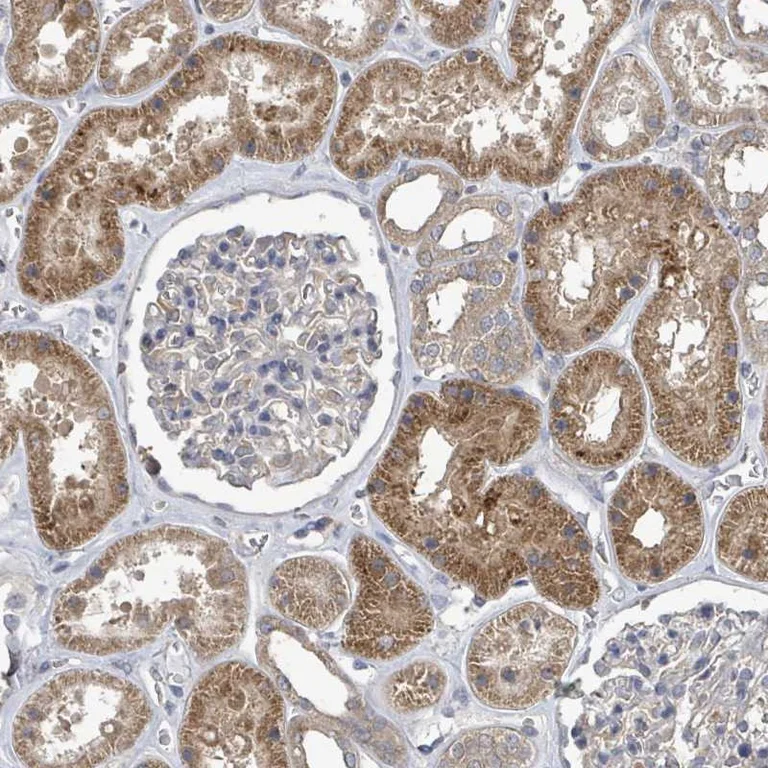 Immunohistochemistry (Formalin/PFA-fixed paraffin-embedded sections) - Anti-NHE-7 antibody (AB272649)