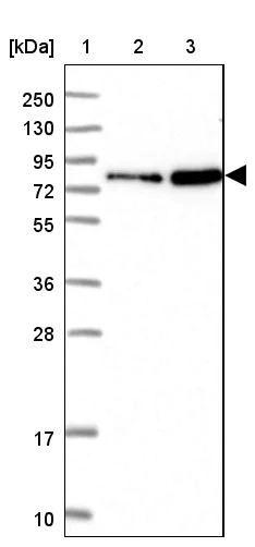 Western blot - Anti-NHE-7 antibody (AB272649)