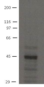 Western blot - Anti-NHERF-2/SIP-1 antibody [32B6] (AB151443)