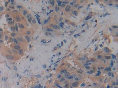 Immunohistochemistry (Formalin/PFA-fixed paraffin-embedded sections) - Anti-NHERF-2/SIP-1 antibody (AB233167)