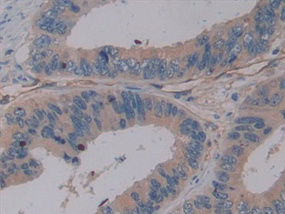 Immunohistochemistry (Formalin/PFA-fixed paraffin-embedded sections) - Anti-NHERF-2/SIP-1 antibody (AB233167)