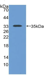 Western blot - Anti-NHERF-2/SIP-1 antibody (AB233167)