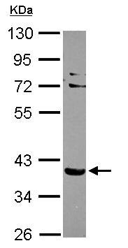 Western blot - Anti-NHERF-2/SIP-1 antibody (AB96562), expandable thumbnail