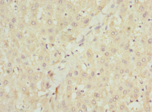 Immunohistochemistry (Formalin/PFA-fixed paraffin-embedded sections) - Anti-NHLRC1/Malin antibody (AB225919)