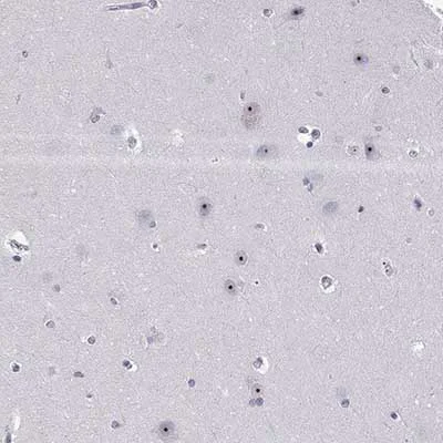 Immunohistochemistry (Formalin/PFA-fixed paraffin-embedded sections) - Anti-NHP2 antibody (AB204352)