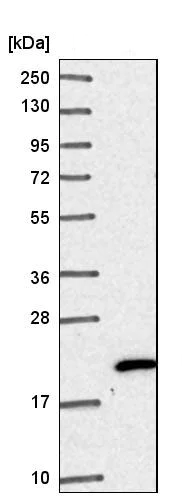 Western blot - Anti-NHP2 antibody (AB204352)