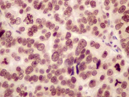 Immunohistochemistry (Formalin/PFA-fixed paraffin-embedded sections) - Anti-NHP2 antibody [EPR12404] - BSA and Azide free (AB250201)