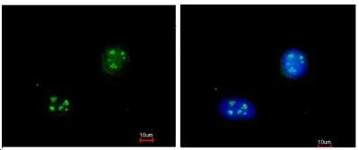 Immunocytochemistry/ Immunofluorescence - Anti-NHP2L1 antibody (AB95958)