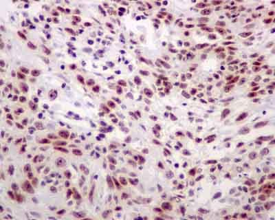 Immunohistochemistry (Formalin/PFA-fixed paraffin-embedded sections) - Anti-NHP2L1 antibody [EPR11671] - BSA and Azide free (AB250549), expandable thumbnail