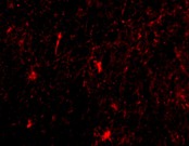 Immunocytochemistry/ Immunofluorescence - Anti-Nicastrin antibody (AB45425)