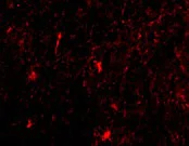 Immunocytochemistry/ Immunofluorescence - Anti-Nicastrin antibody (AB45425)
