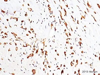 Immunohistochemistry (Formalin/PFA-fixed paraffin-embedded sections) - Anti-Nicastrin antibody (AB45425)
