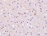 Immunohistochemistry (Formalin/PFA-fixed paraffin-embedded sections) - Anti-Nicastrin antibody (AB45425)