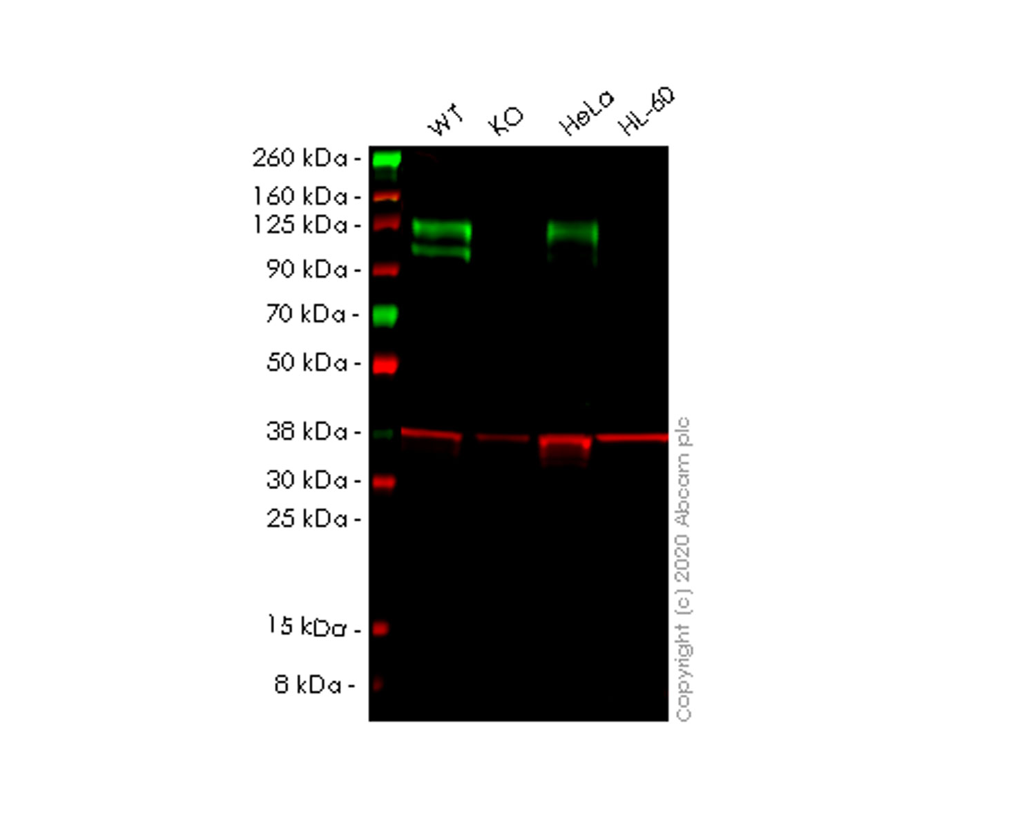 Western blot - Anti-Nicastrin antibody [EPR2575Y] (AB68145)
