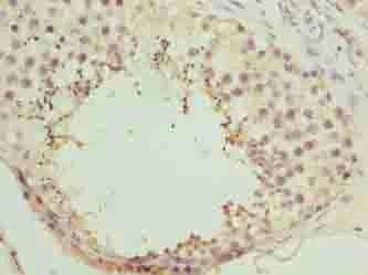 Immunohistochemistry (Formalin/PFA-fixed paraffin-embedded sections) - Anti-NICN1 antibody (AB235314)
