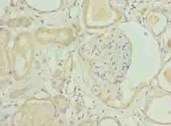 Immunohistochemistry (Formalin/PFA-fixed paraffin-embedded sections) - Anti-NICN1 antibody (AB235314)