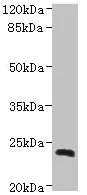 Western blot - Anti-NICN1 antibody (AB235314)