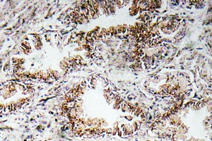 Immunohistochemistry (Formalin/PFA-fixed paraffin-embedded sections) - Anti-Nicotinic Acetylcholine Receptor alpha 1/CHRNA1 antibody (AB135272), expandable thumbnail