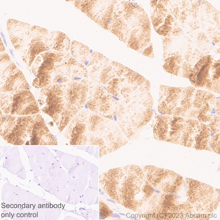 Immunohistochemistry (Formalin/PFA-fixed paraffin-embedded sections) - Anti-Nicotinic Acetylcholine Receptor alpha 1/CHRNA1 antibody [EPR27397-4] (ab308306), expandable thumbnail