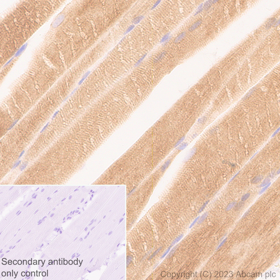 Immunohistochemistry (Formalin/PFA-fixed paraffin-embedded sections) - Anti-Nicotinic Acetylcholine Receptor alpha 1/CHRNA1 antibody [EPR27397-4] (ab308306), expandable thumbnail