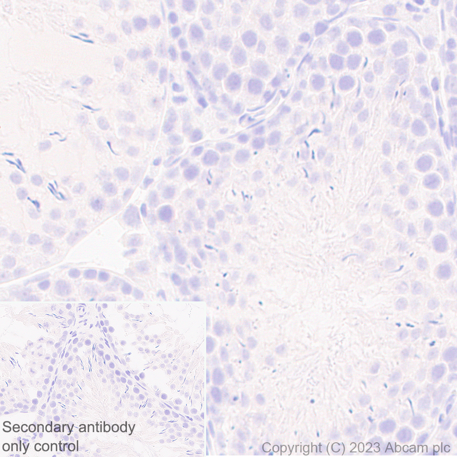 Immunohistochemistry (Formalin/PFA-fixed paraffin-embedded sections) - Anti-Nicotinic Acetylcholine Receptor alpha 1/CHRNA1 antibody [EPR27397-4] (AB308306), expandable thumbnail