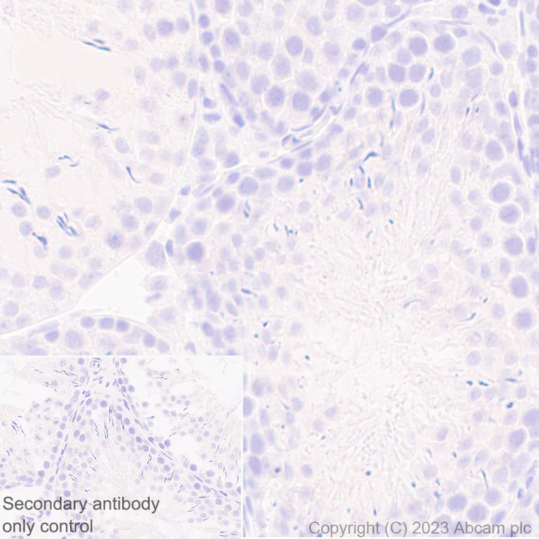 Immunohistochemistry (Formalin/PFA-fixed paraffin-embedded sections) - Anti-Nicotinic Acetylcholine Receptor alpha 1/CHRNA1 antibody [EPR27397-4] (AB308306)