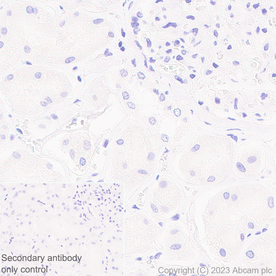Immunohistochemistry (Formalin/PFA-fixed paraffin-embedded sections) - Anti-Nicotinic Acetylcholine Receptor alpha 1/CHRNA1 antibody [EPR27397-4] (AB308306), expandable thumbnail