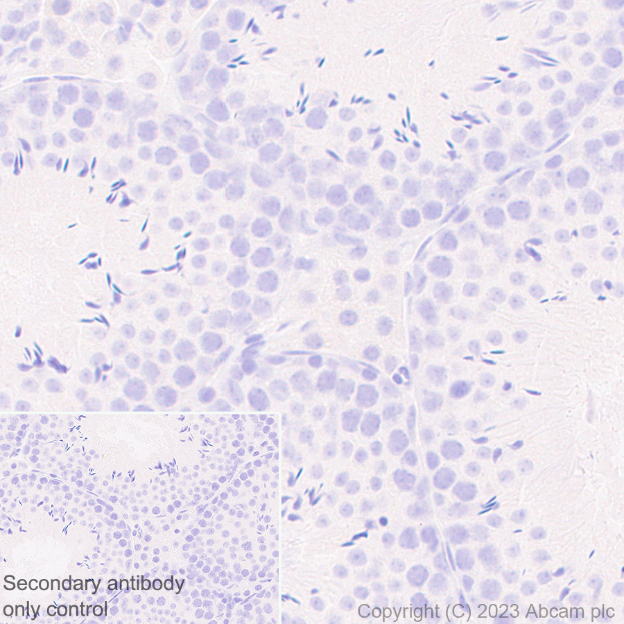Immunohistochemistry (Formalin/PFA-fixed paraffin-embedded sections) - Anti-Nicotinic Acetylcholine Receptor alpha 1/CHRNA1 antibody [EPR27397-4] (AB308306), expandable thumbnail