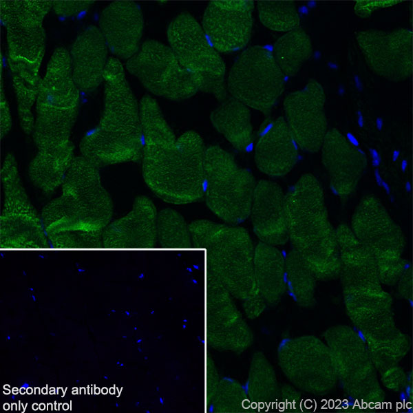 Immunohistochemistry (Frozen sections) - Anti-Nicotinic Acetylcholine Receptor alpha 1/CHRNA1 antibody [EPR27397-4] (ab308306), expandable thumbnail