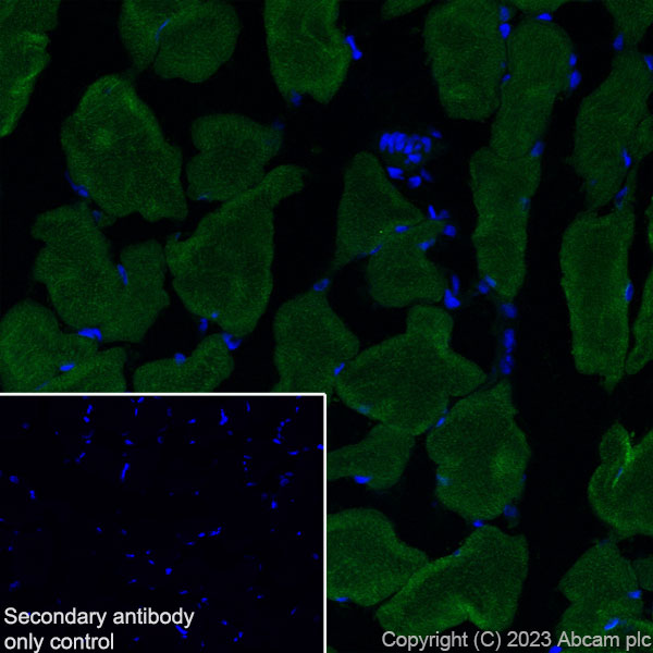 Immunohistochemistry (Frozen sections) - Anti-Nicotinic Acetylcholine Receptor alpha 1/CHRNA1 antibody [EPR27397-4] (ab308306), expandable thumbnail