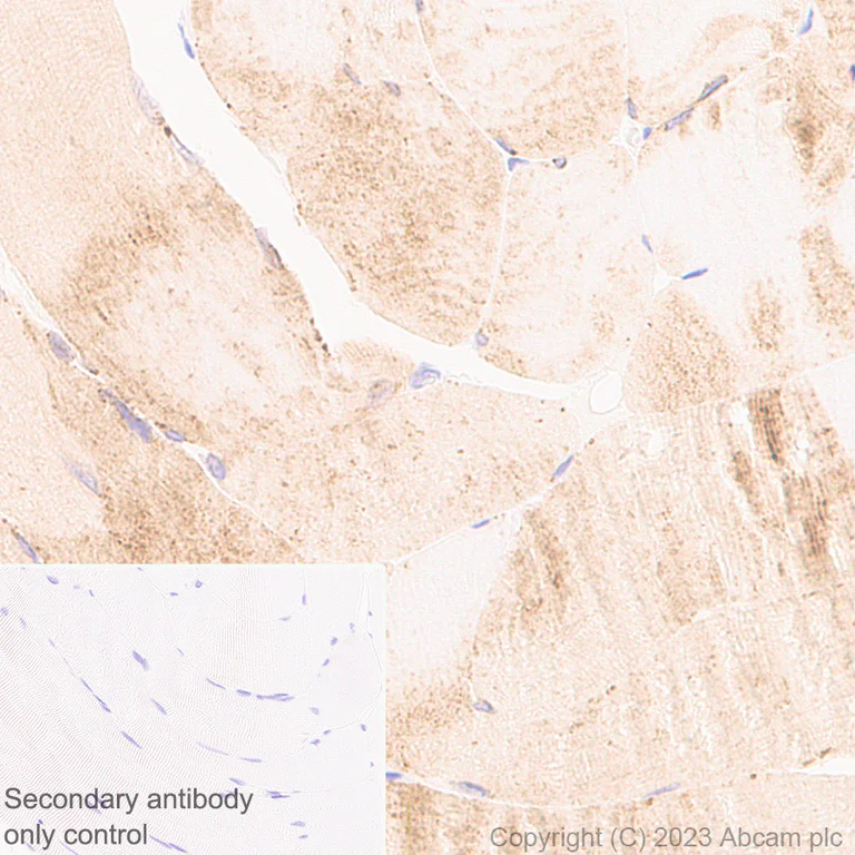 Immunohistochemistry (Formalin/PFA-fixed paraffin-embedded sections) - Anti-Nicotinic Acetylcholine Receptor alpha 1/CHRNA1 antibody [EPR27397-4] - BSA and Azide free (AB308307)