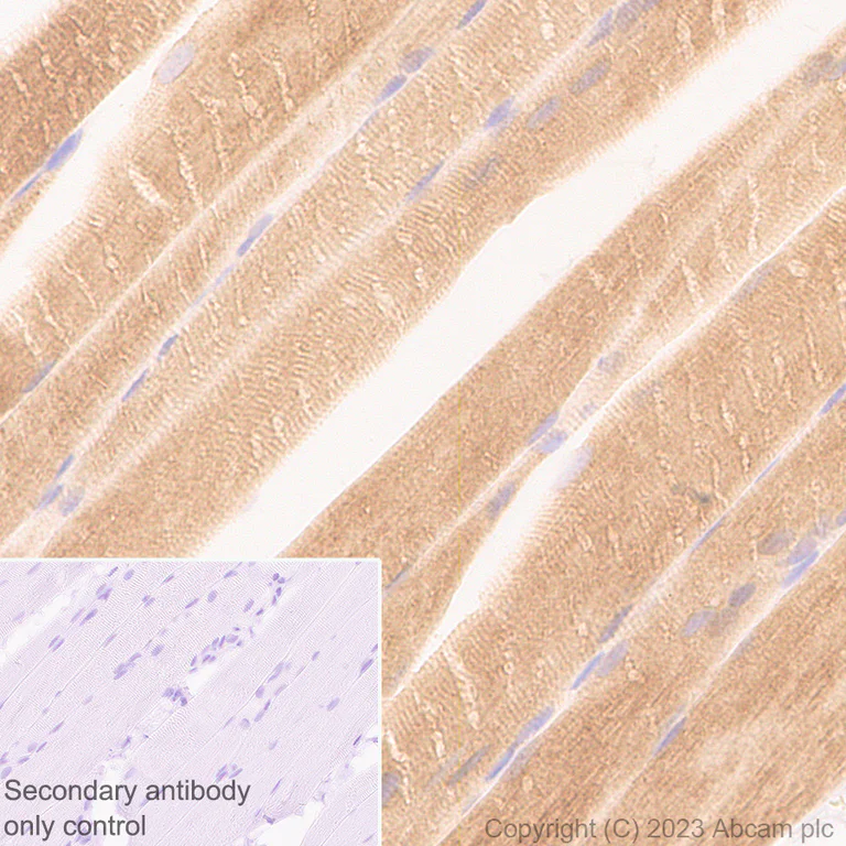 Immunohistochemistry (Formalin/PFA-fixed paraffin-embedded sections) - Anti-Nicotinic Acetylcholine Receptor alpha 1/CHRNA1 antibody [EPR27397-4] - BSA and Azide free (AB308307)