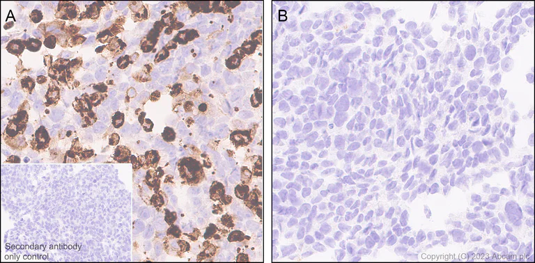 Immunohistochemistry (Formalin/PFA-fixed paraffin-embedded sections) - Anti-Nicotinic Acetylcholine Receptor alpha 1/CHRNA1 antibody [EPR27397-4] - BSA and Azide free (AB308307)