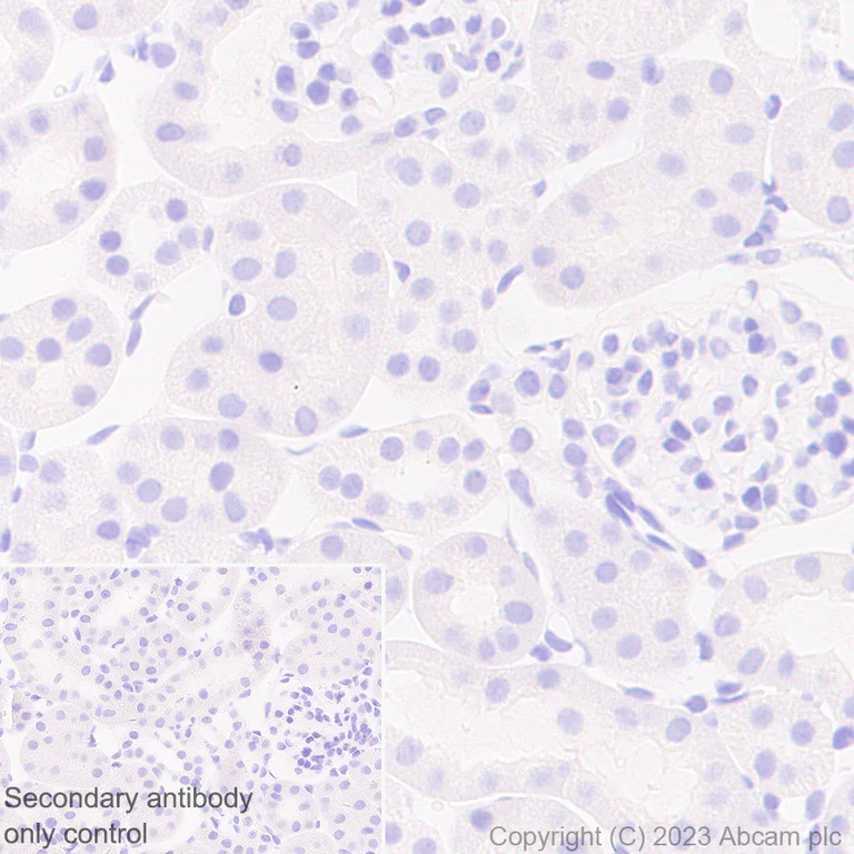 Immunohistochemistry (Formalin/PFA-fixed paraffin-embedded sections) - Anti-Nicotinic Acetylcholine Receptor alpha 1/CHRNA1 antibody [EPR27397-4] - BSA and Azide free (AB308307)