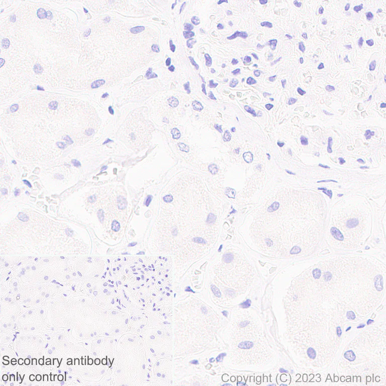 Immunohistochemistry (Formalin/PFA-fixed paraffin-embedded sections) - Anti-Nicotinic Acetylcholine Receptor alpha 1/CHRNA1 antibody [EPR27397-4] - BSA and Azide free (AB308307)