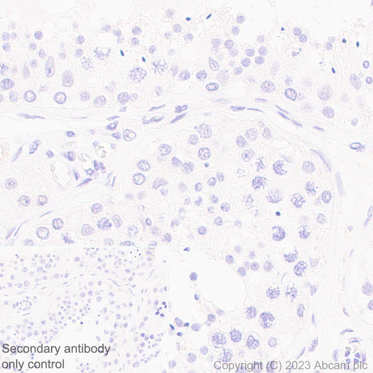 Immunohistochemistry (Formalin/PFA-fixed paraffin-embedded sections) - Anti-Nicotinic Acetylcholine Receptor alpha 1/CHRNA1 antibody [EPR27397-4] - BSA and Azide free (AB308307)