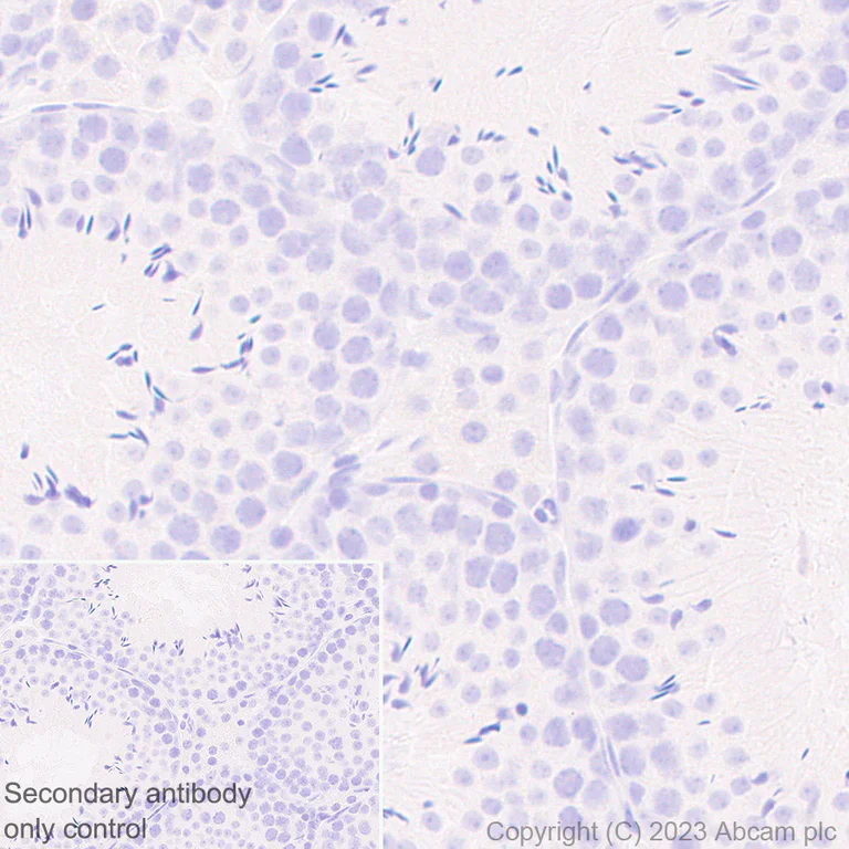 Immunohistochemistry (Formalin/PFA-fixed paraffin-embedded sections) - Anti-Nicotinic Acetylcholine Receptor alpha 1/CHRNA1 antibody [EPR27397-4] - BSA and Azide free (AB308307)
